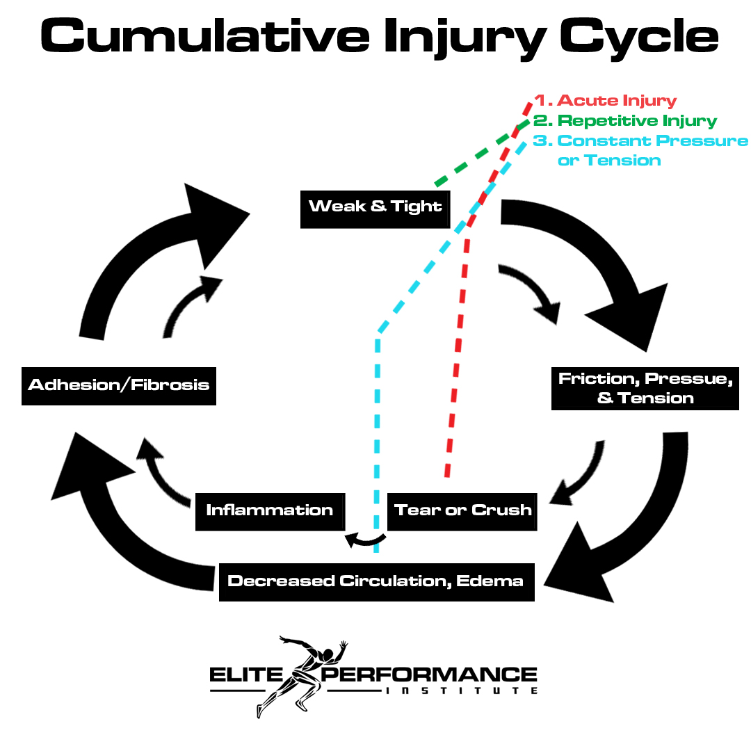 Read more about the article Cumulative Injury Cycle