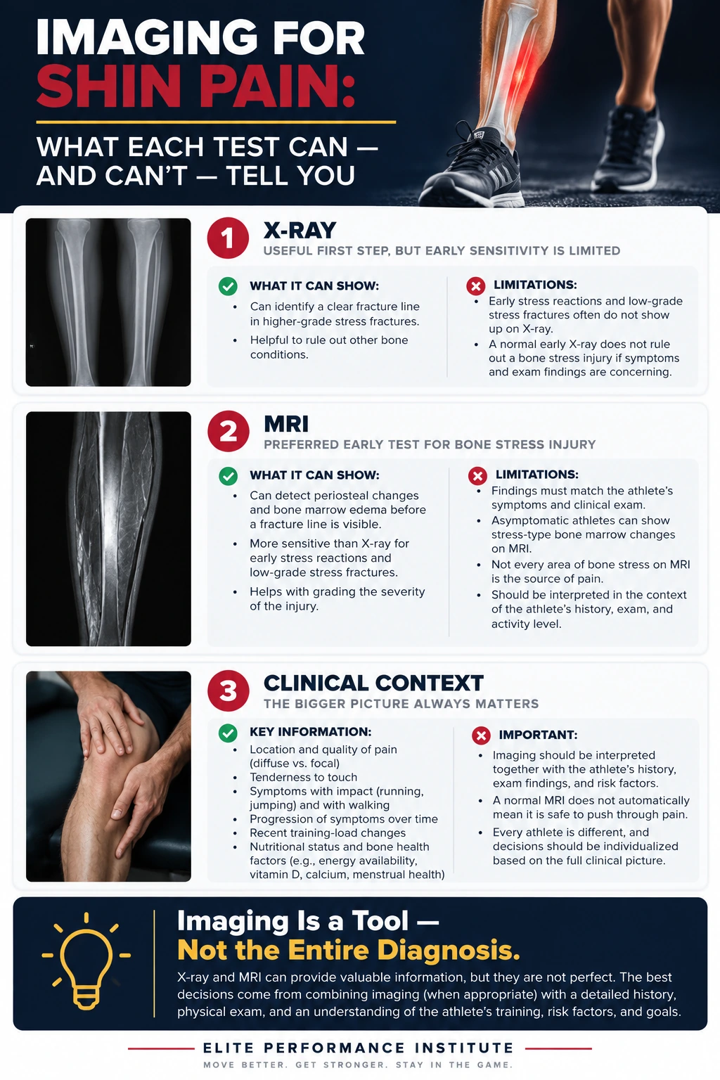 Imaging for Shin Pain and Bone Stress Injury Shin pain imaging infographic explaining that early X-rays may be negative MRI is preferred for early bone stress injury and imaging must match symptoms