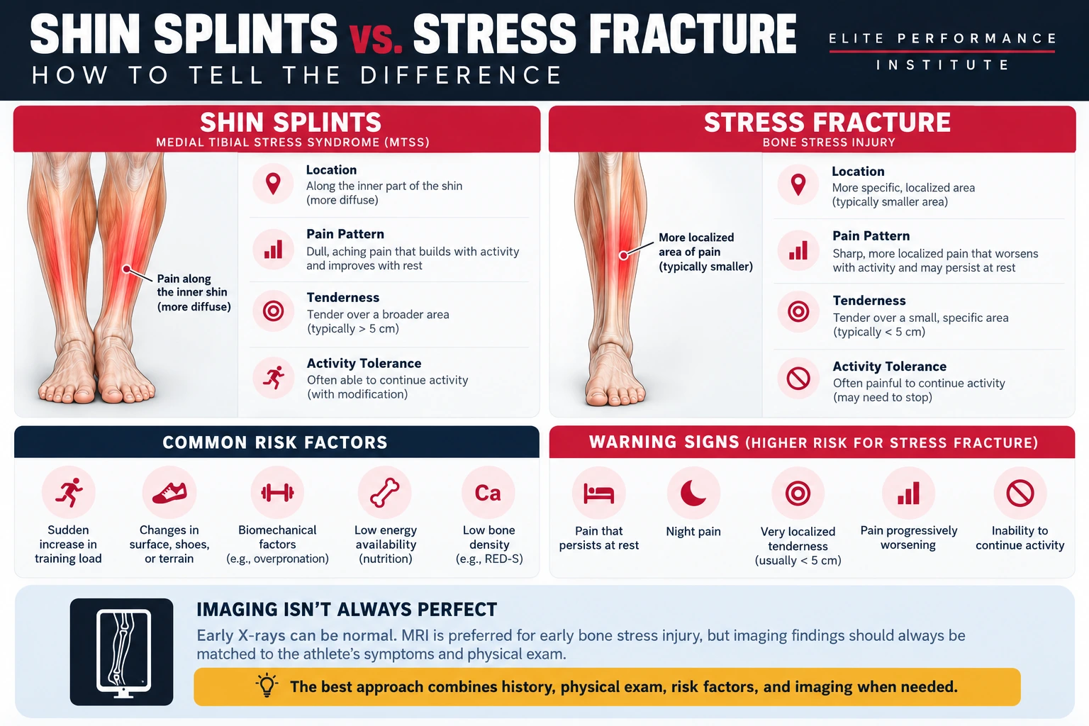 Shin Splints vs. Stress Fracture Shin splints versus tibial stress fracture infographic comparing pain location tenderness activity response and warning signs